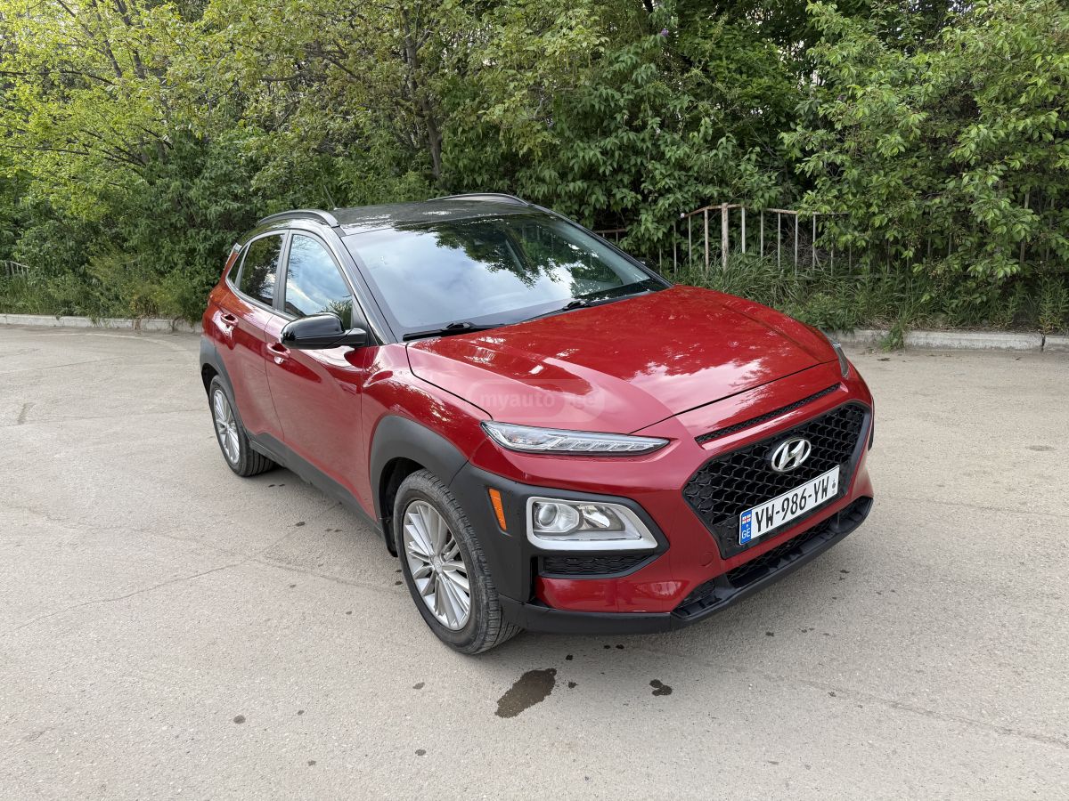 Hyundai Kona - фото 2