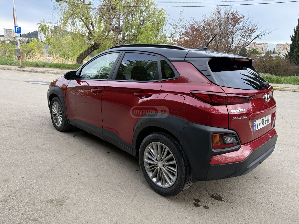 Hyundai Kona - фото 4