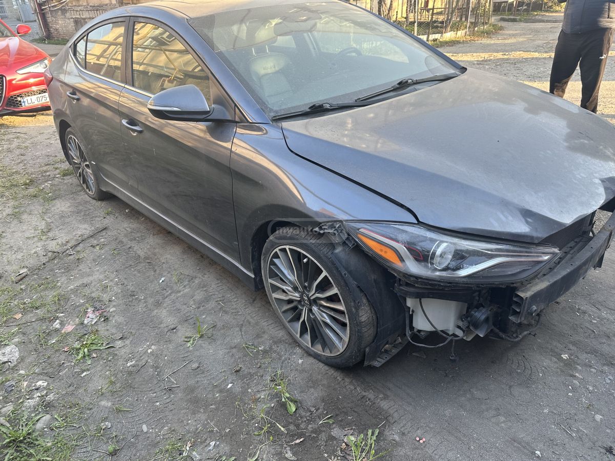 Hyundai Elantra - фото 2