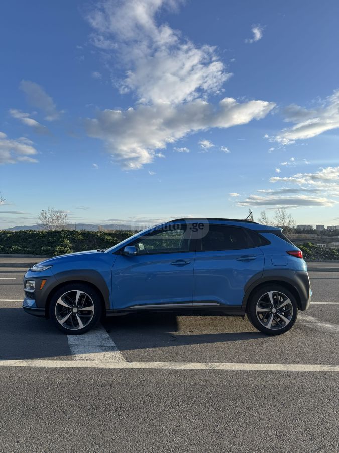 Hyundai Kona - фото 8