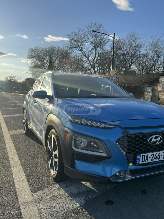 Hyundai kona - фото 2
