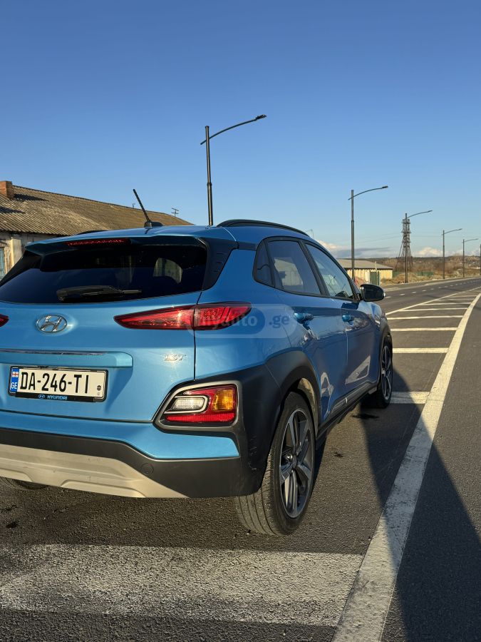 Hyundai kona - фото 5