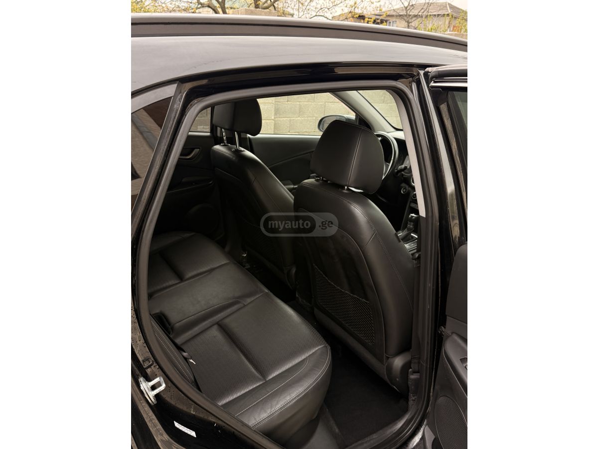 Hyundai Kona - фото 5