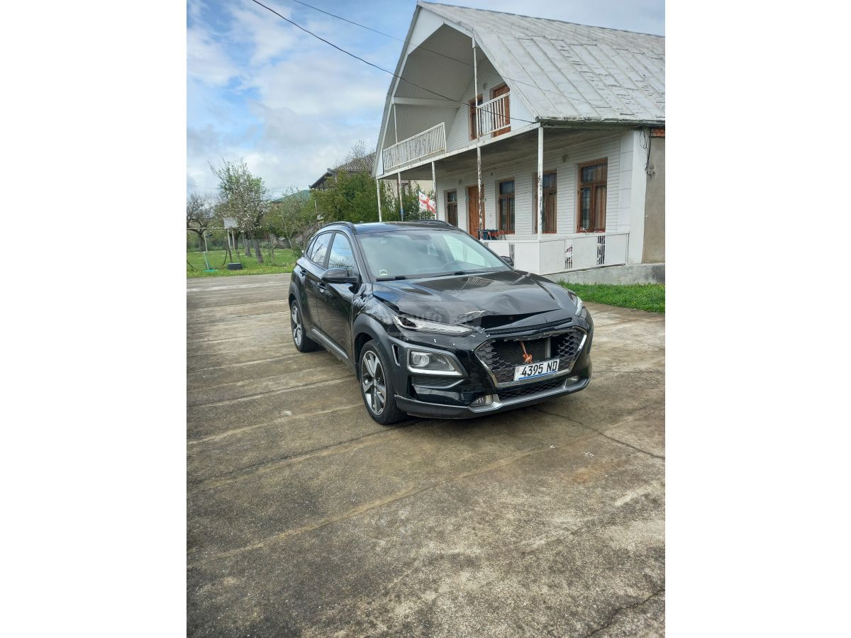 Hyundai kona - фото 2