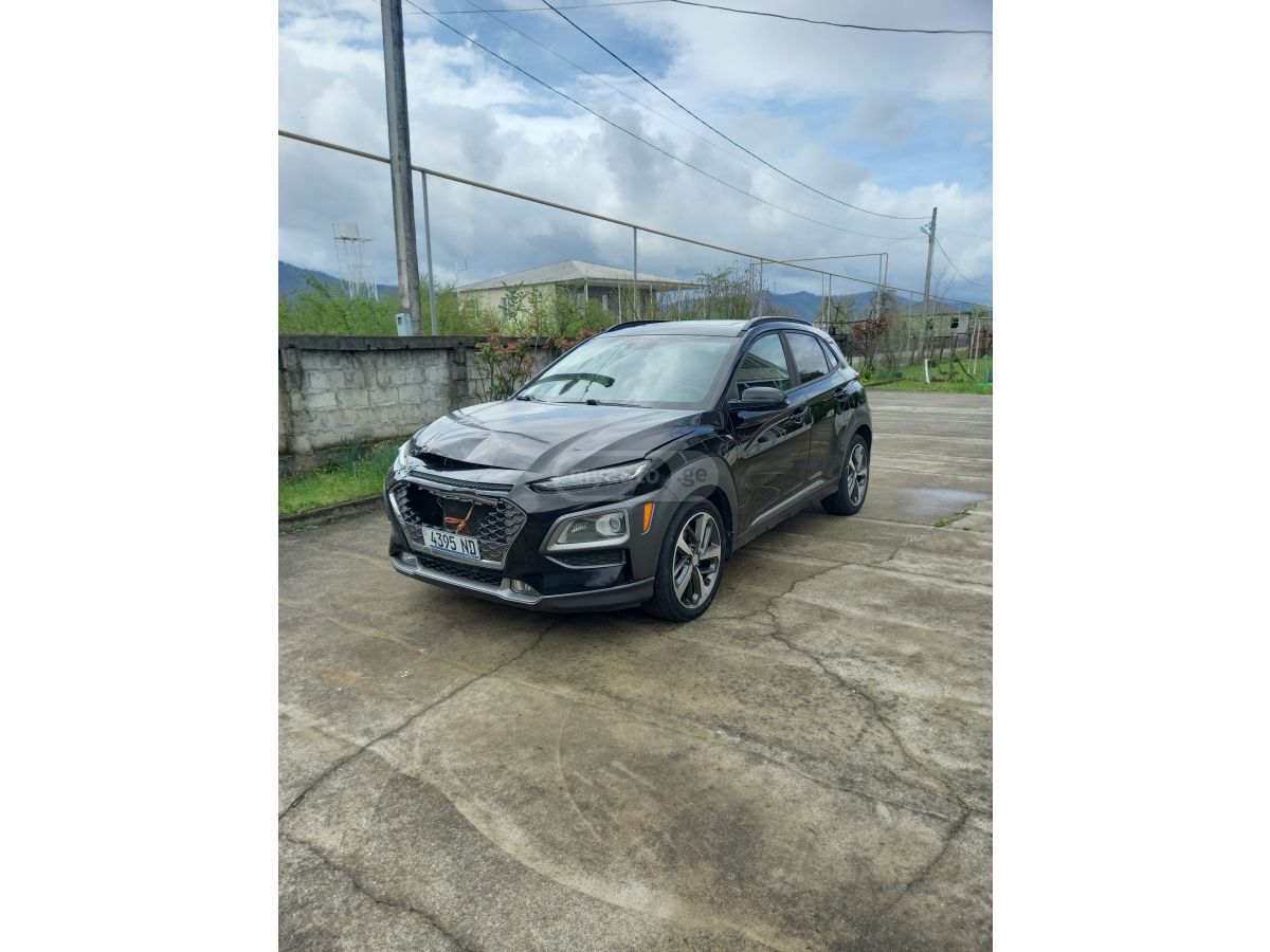 Hyundai kona - фото 3